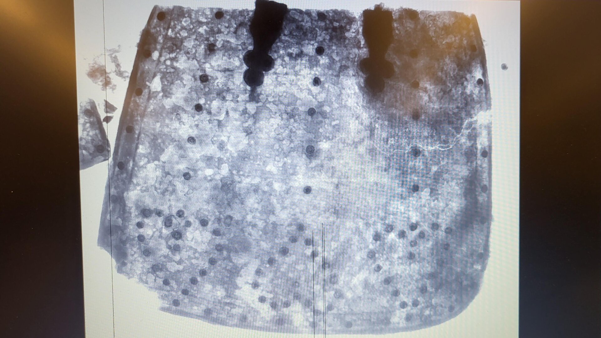 Une image aux rayons X du tasset a révélé des éléments en métallurgie décoratifs.