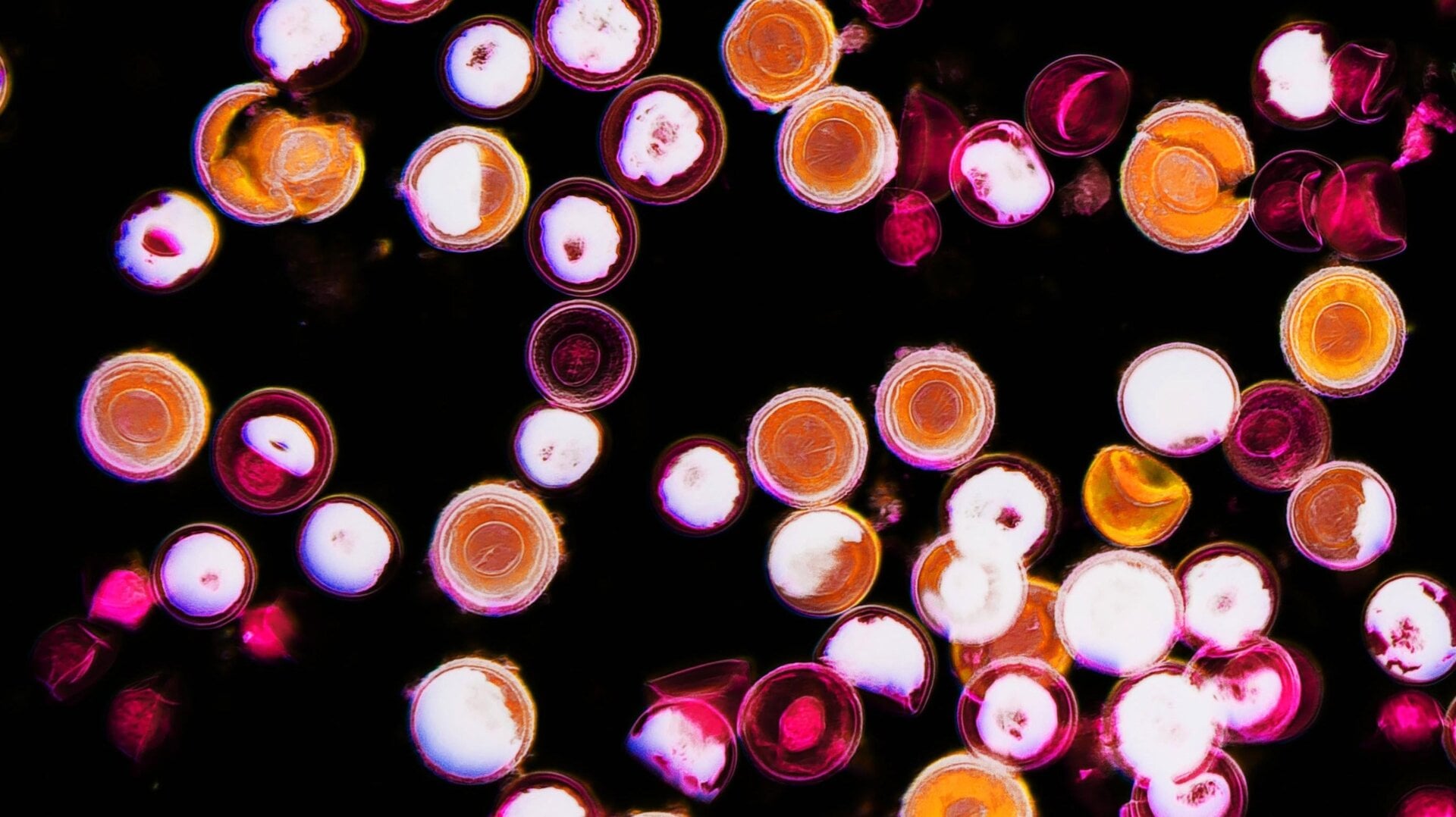 Une photo de ténia (Ténia) œufs sous un microscope améliorés pour montrer leur structure interne.