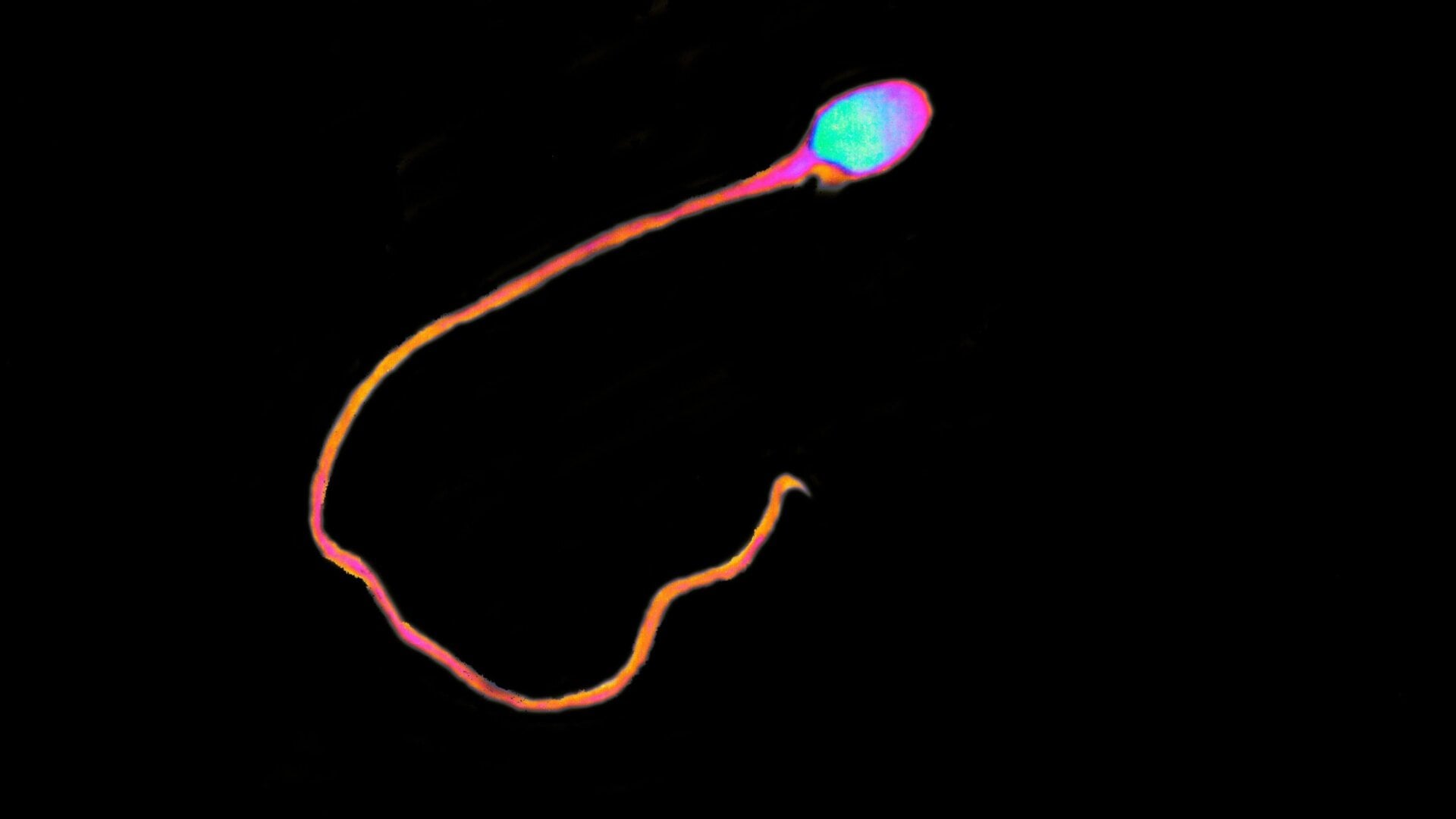 Un seul spermatozoïde mobile, ou spermatozoïde.